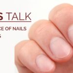 nail changes