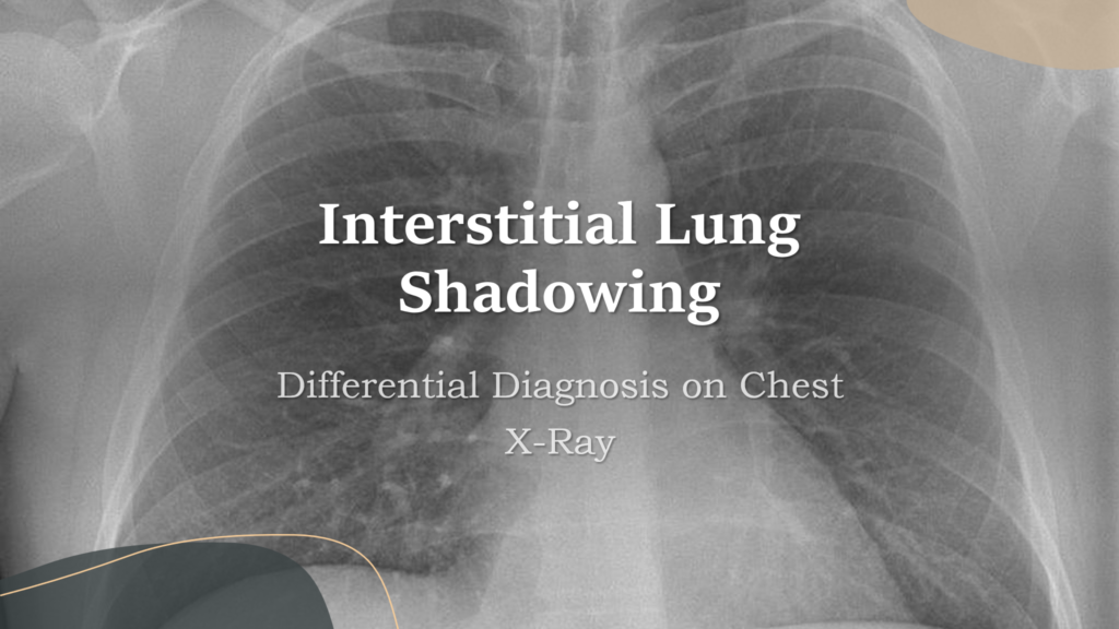 Interstitial Lung Shadows