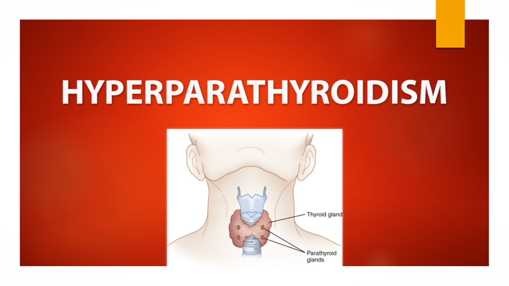 hyperparathyroidism
