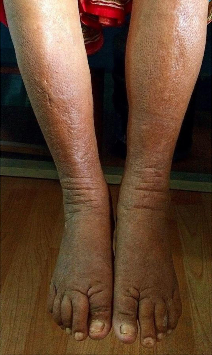 Skin rash: Differential Diagnoses of skin rash on shins