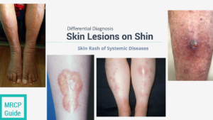 skin rash in shin