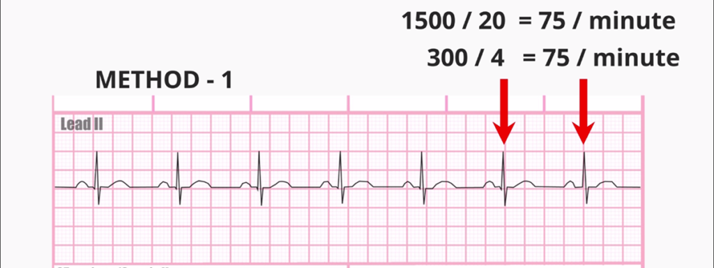 ECG rate calculation