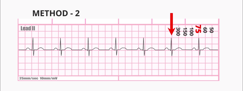 rate calculation ecg