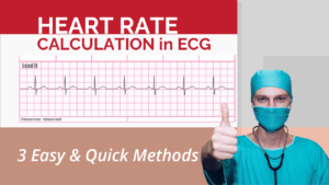 Heart Rate in ECGs