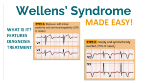wellen syndrome